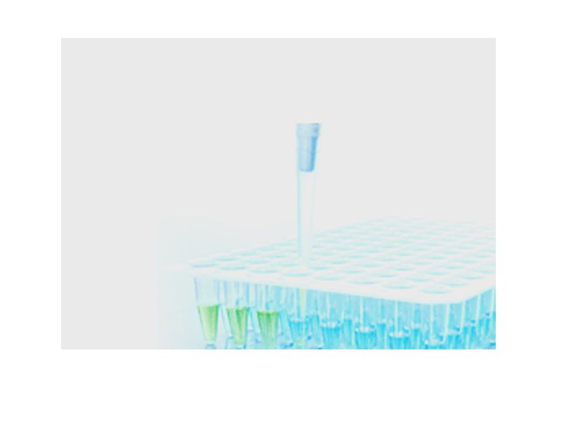 Read more about the article QuantiNova加速您的荧光定量PCR实验
