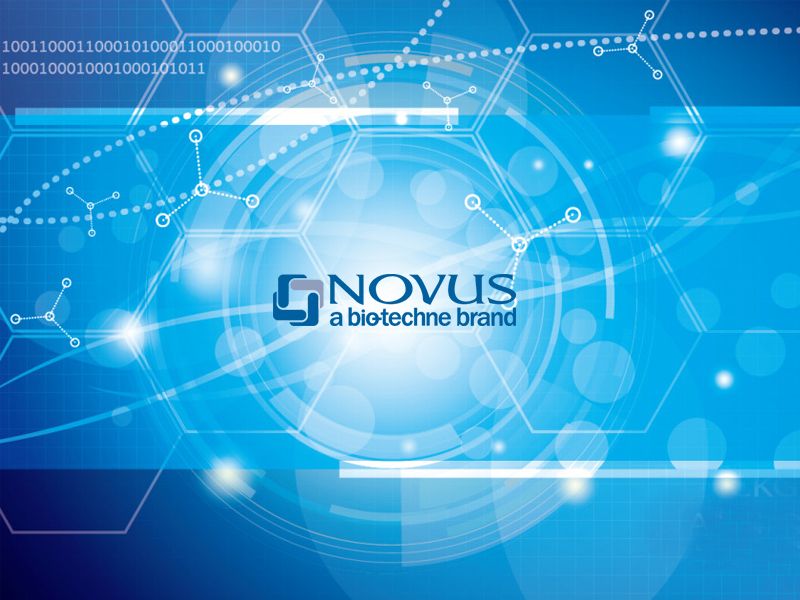 Read more about the article Novus自噬产品精选:Akt（蛋白激酶B）