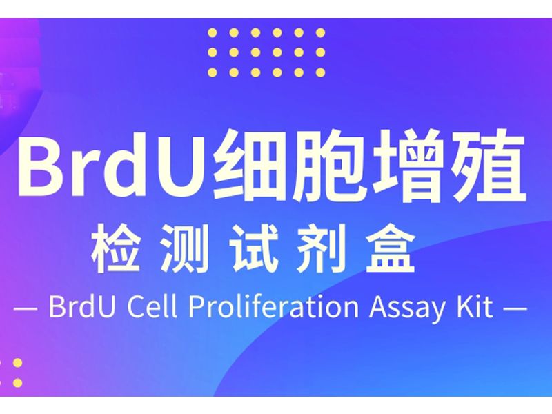 Read more about the article BrdU细胞增殖检测试剂盒